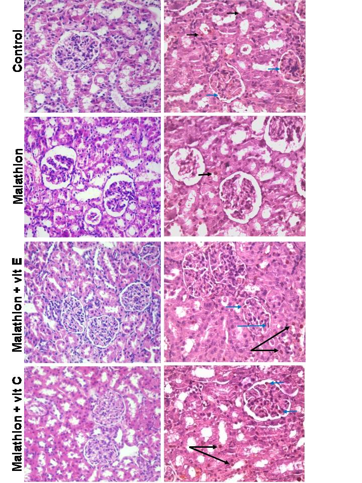 HISTOPATHOLOGICAL INSIGHT ON MALATHION INDUCED NEPHROPATHY WHICH IS AMELIORATED BY ANTIOXIDANTS USE; AN ANIMAL MODEL